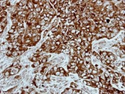 Invitrogen PPP3CB Polyclonal Antibody 100 &mu;L; Unconjugated:Antibodies,
