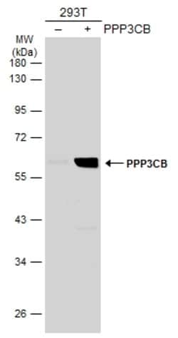 Invitrogen PPP3CB Polyclonal Antibody 100 &mu;L; Unconjugated:Antibodies,