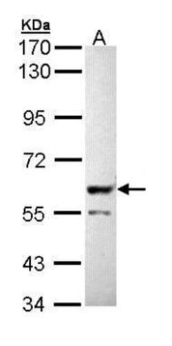 Invitrogen PPP3CB Polyclonal Antibody 100 &mu;L; Unconjugated:Antibodies,