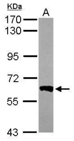 Invitrogen PPP3CB Polyclonal Antibody 100 &mu;L; Unconjugated:Antibodies,