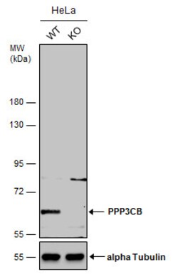 Invitrogen PPP3CB Polyclonal Antibody 100 &mu;L; Unconjugated:Antibodies,