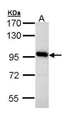 Invitrogen ATP6V0A4 Polyclonal Antibody 100 &mu;L; Unconjugated:Antibodies,
