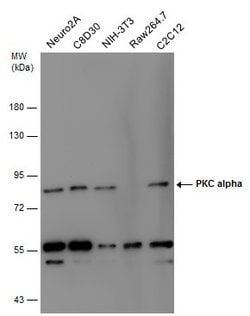 Invitrogen PKC alpha Polyclonal Antibody 100 &mu;L | Buy Online | Invitrogen&trade; | Fisher Scientific