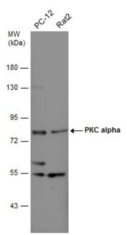 Invitrogen PKC alpha Polyclonal Antibody 100 &mu;L | Buy Online | Invitrogen&trade; | Fisher Scientific