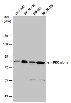 Invitrogen PKC alpha Polyclonal Antibody 100 &mu;L | Buy Online | Invitrogen&trade; | Fisher Scientific