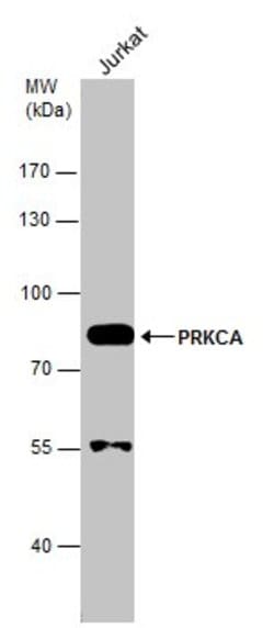 Invitrogen PKC alpha Polyclonal Antibody 100 &mu;L | Buy Online | Invitrogen&trade; | Fisher Scientific