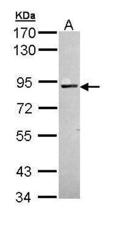 Invitrogen PKC alpha Polyclonal Antibody 100 &mu;L | Buy Online | Invitrogen&trade; | Fisher Scientific