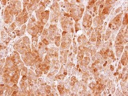 Invitrogen MVD Polyclonal Antibody 100 &mu;L; Unconjugated:Antibodies,