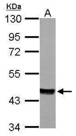 Invitrogen MVD Polyclonal Antibody 100 &mu;L; Unconjugated:Antibodies,