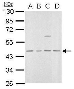Invitrogen MVD Polyclonal Antibody 100 &mu;L; Unconjugated:Antibodies,