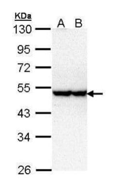 Invitrogen STK40 Polyclonal Antibody 100 &mu;L; Unconjugated:Antibodies,