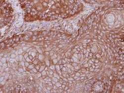 Invitrogen MPP1 Polyclonal Antibody 100 &mu;L | Buy Online | Invitrogen&trade; | Fisher Scientific