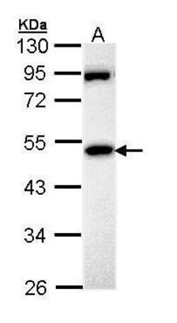Invitrogen MPP1 Polyclonal Antibody 100 &mu;L | Buy Online | Invitrogen&trade; | Fisher Scientific