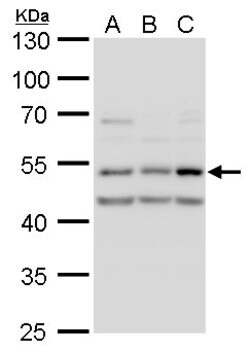 Invitrogen CaMKII delta Polyclonal Antibody 100 &mu;L | Buy Online | Invitrogen&trade; | Fisher Scientific