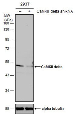 Invitrogen CaMKII delta Polyclonal Antibody 100 &mu;L | Buy Online | Invitrogen&trade; | Fisher Scientific