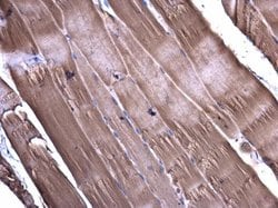 Invitrogen CaMKII delta Polyclonal Antibody 100 &mu;L | Buy Online | Invitrogen&trade; | Fisher Scientific