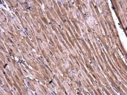 Invitrogen CaMKII delta Polyclonal Antibody 100 &mu;L | Buy Online | Invitrogen&trade; | Fisher Scientific