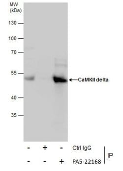 Invitrogen CaMKII delta Polyclonal Antibody 100 &mu;L | Buy Online | Invitrogen&trade; | Fisher Scientific