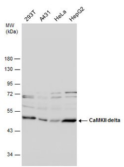 Invitrogen CaMKII delta Polyclonal Antibody 100 &mu;L | Buy Online | Invitrogen&trade; | Fisher Scientific