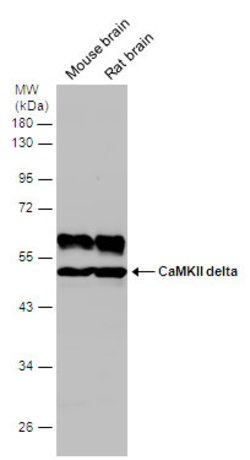 Invitrogen CaMKII delta Polyclonal Antibody 100 &mu;L | Buy Online | Invitrogen&trade; | Fisher Scientific