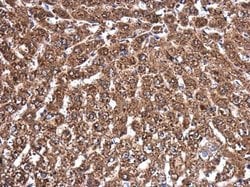 Invitrogen MVD Polyclonal Antibody 100 &mu;L; Unconjugated:Antibodies,