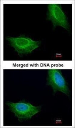 Invitrogen ADCK1 Polyclonal Antibody 100 &mu;L; Unconjugated:Antibodies,