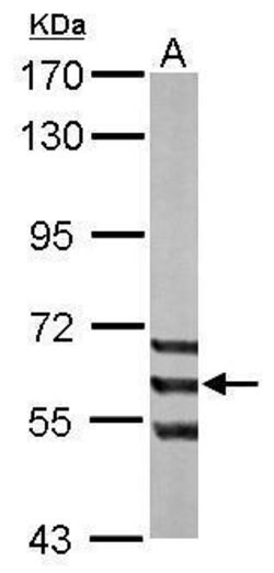 Invitrogen ADCK1 Polyclonal Antibody 100 &mu;L; Unconjugated:Antibodies,