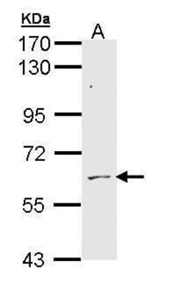 Invitrogen ADCK1 Polyclonal Antibody 100 &mu;L; Unconjugated:Antibodies,