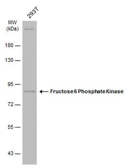 Invitrogen PFKM Polyclonal Antibody 100 &mu;L; Unconjugated:Antibodies,