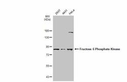 Invitrogen PFKM Polyclonal Antibody 100 &mu;L; Unconjugated:Antibodies,