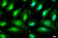 Invitrogen ULK2 Polyclonal Antibody 100 &mu;L; Unconjugated:Antibodies,