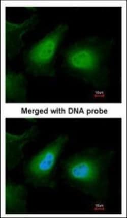 Invitrogen ULK2 Polyclonal Antibody 100 &mu;L; Unconjugated:Antibodies,