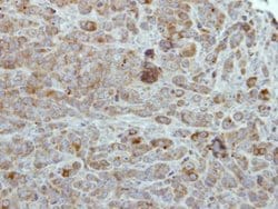 Invitrogen ULK2 Polyclonal Antibody 100 &mu;L; Unconjugated:Antibodies,