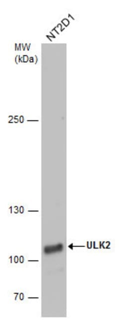 Invitrogen ULK2 Polyclonal Antibody 100 &mu;L; Unconjugated:Antibodies,