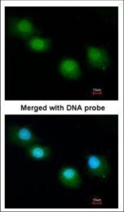 Invitrogen Ubiquilin 1 Polyclonal Antibody 100 &mu;L; Unconjugated:Antibodies,