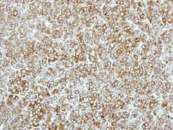 Invitrogen EEF2K Polyclonal Antibody 100 &mu;L; Unconjugated:Antibodies,