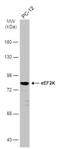Invitrogen EEF2K Polyclonal Antibody 100 &mu;L; Unconjugated:Antibodies,