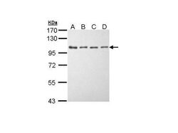 Invitrogen EEF2K Polyclonal Antibody 100 &mu;L; Unconjugated:Antibodies,