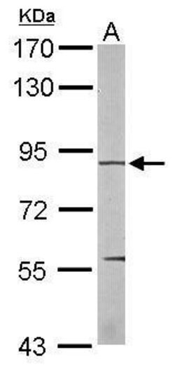 Invitrogen EEF2K Polyclonal Antibody 100 &mu;L; Unconjugated:Antibodies,