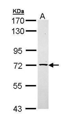 Invitrogen TXNDC3 Polyclonal Antibody 100 &mu;L | Buy Online | Invitrogen&trade; | Fisher Scientific