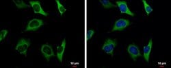 Invitrogen PKLR Polyclonal Antibody 100 μL; Unconjugated:Antibodies,