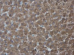 Invitrogen PKLR Polyclonal Antibody 100 μL; Unconjugated:Antibodies,