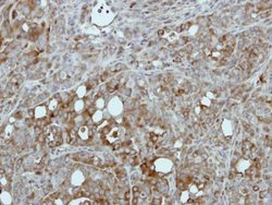 Invitrogen PKLR Polyclonal Antibody 100 μL; Unconjugated:Antibodies,