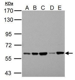 Invitrogen PKLR Polyclonal Antibody 100 μL; Unconjugated:Antibodies,