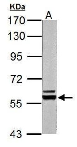 Invitrogen PKLR Polyclonal Antibody 100 μL; Unconjugated:Antibodies,