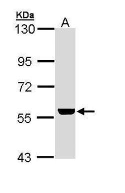 Invitrogen ADCK4 Polyclonal Antibody 100 &mu;L; Unconjugated:Antibodies,