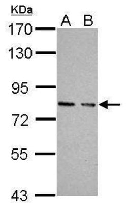 Invitrogen cGKI Polyclonal Antibody 100 &mu;L; Unconjugated:Antibodies,