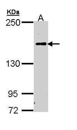 Invitrogen Complement C5 Polyclonal Antibody 100 &mu;L | Buy Online | Invitrogen&trade; | Fisher Scientific