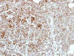 Invitrogen PDE1A Polyclonal Antibody 100 &mu;L | Buy Online | Invitrogen&trade; | Fisher Scientific