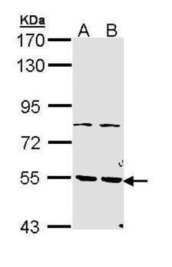 Invitrogen PDE1A Polyclonal Antibody 100 &mu;L | Buy Online | Invitrogen&trade; | Fisher Scientific